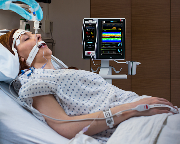 Patient monitored with SedLine and O3 on Root in PACU