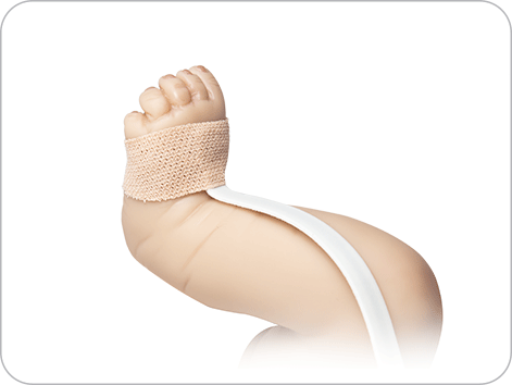 RD SET Neo – foot application